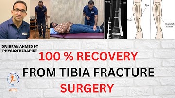 Learn Everything About Lower leg fractures Recovery & Exercises at Home | Urdu |Hindi