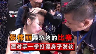 Zhang Weili was beaten unconscious, and her nosebleeds could not be stopped