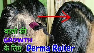 बालो की Growth कैसे करे Fast |Which Derma Roller Is Best For Hair Growth|Hair Care Tips Shinny Roops