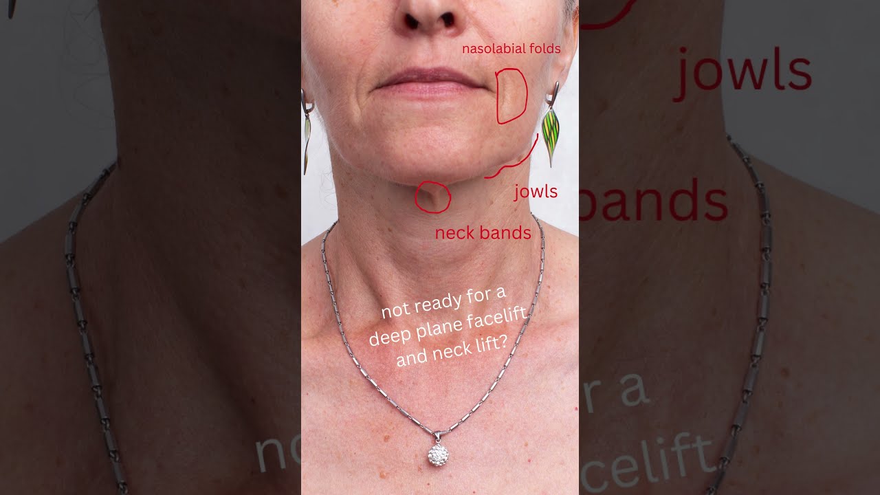 Seeing these signs of aging on your face? You are not a candidate for deep plane facelift!
