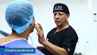 Tratamiento de cicatrices | Clínica Dermatológica Ollague Tratamiento de cicatrices | Clínica Dermatológica Ollague