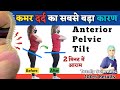        anterior pelvic tilt correction exercises in hindi  dr deepak soni