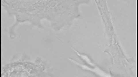 Structure and elastic properties of tunneling nanotubes