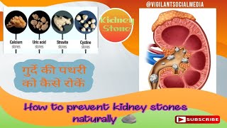 05 Food's to prevent kidney stones | गुर्दे की पथरी को कैसे रोकें | گردے کی پتھری کو کیسے روکا جائے