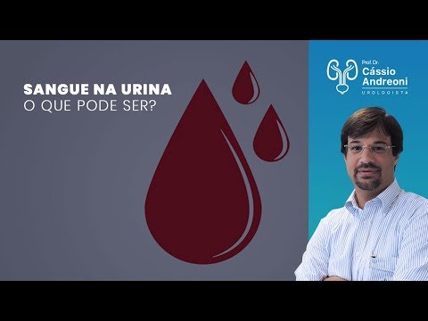 Sangue na urina, o que pode ser? | Dr. Cassio Andreoni CRM 78.546