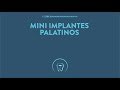 Mini Implante Palatino - Técnica Sistema Peclab