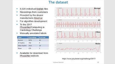 Convolutional neural network for ECG classification