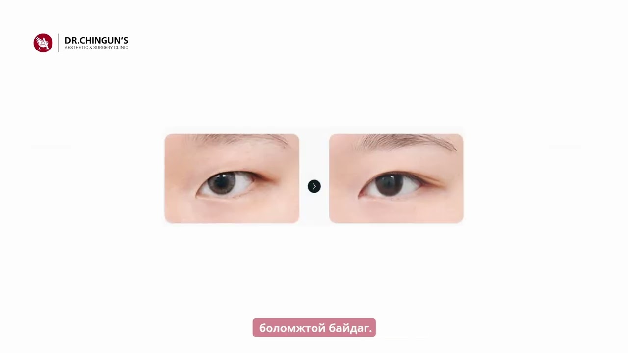 ЭМЧ ТАЙЛБАРЛАХ НЬ: 5. ЗОВХИ, ДАВХРААНЫ МЭС АЖИЛБАР