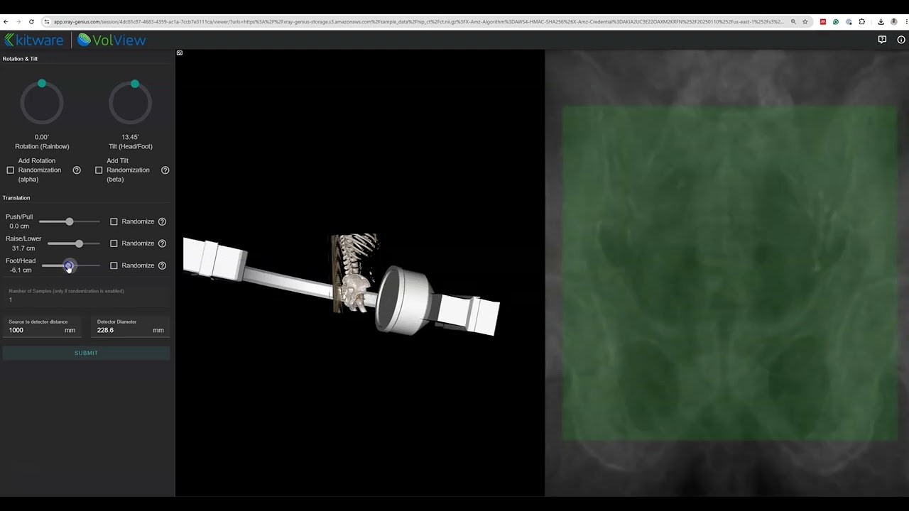 X-Ray Genius Demonstration
