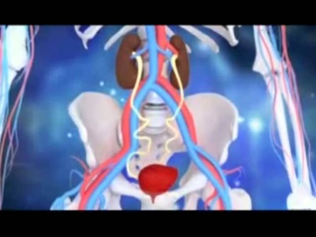 диагностика и лечение цистита. симптомы цистита