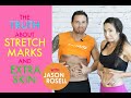 The Truth About Stretch Marks and Extra Skin with Jason Rosell | Natalie Jill
