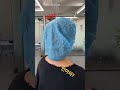 모발이식 아파? 안아피?