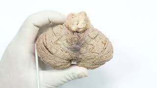 Cerebellum - The Little Brain