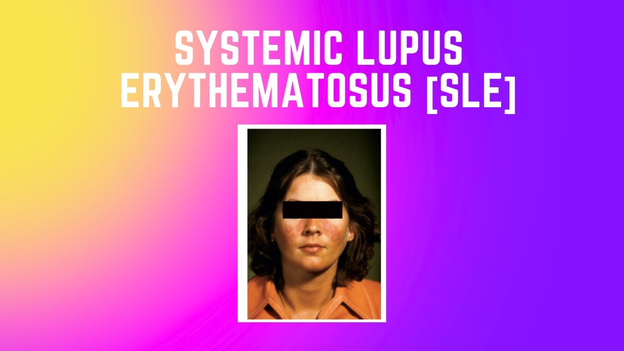 Systemic Lupus Erythematosus [SLE]