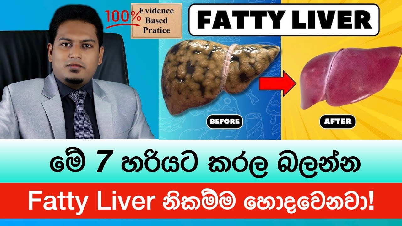 Fatty Liver රිවර්ස් කරන විද්‍යාත්මක  7 | Reverse Fatty Liver By  Nutritionist Hiroshan Jayaranga