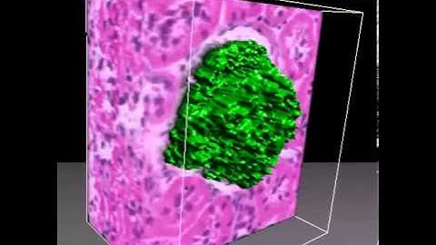 Reconstruction of Glomeruli
