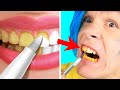 Trying 30 Amazing Hacks For A White Smile || Beauty Tricks and Tips By 5 Minute Crafts