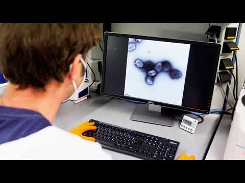 Segundo caso Viruela del Mono Noticia Informativos 13/06/2022