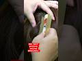 Asmr scalp scratching for psoriasis #psoriasissolution #psoriasis #psoriasiscure @OzleyASMR