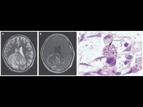 Video: Sind Trypanosoma Einzeller?