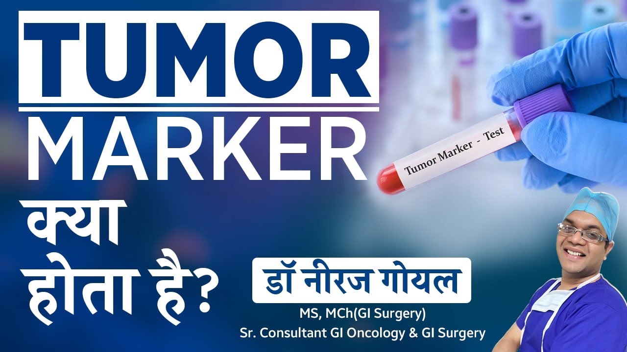 What is the Tumor Marker Test? क्या Tumor Marker से कैंसर detect होता है?