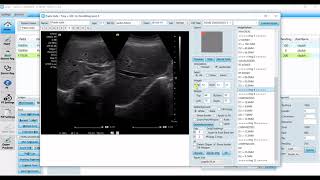 pCare Radiology Tool - Auto Reporting + Offline Annotation Measurement screenshot 5