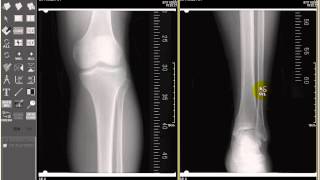 Genesis Omniview - How to view DICOM images