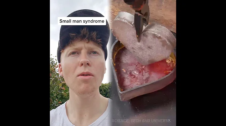 Small man syndrome #fyp #foryou #relate #smallmansyndrome #teatowel #agressive