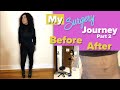 My Lipo 360 Journey Part 2 | Pre Op Surgery and Post Op [Week 1-4] Detailed