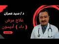 علاج مرض داء أديسون