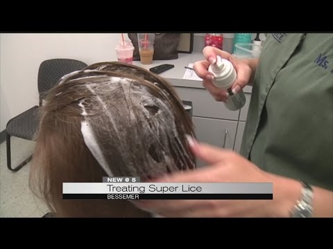 Treating super lice