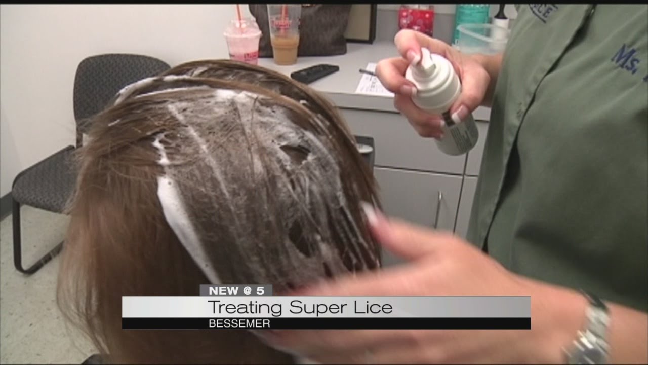 Treating super lice YouTube