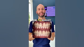 Can Invisalign Close My Front Gap? And How Long Will It Take?