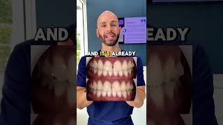 Can Invisalign Close My Front Gap? And How Long Will It Take?