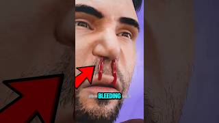 Stop Doing This If Your Nose Bleeds 🚫
