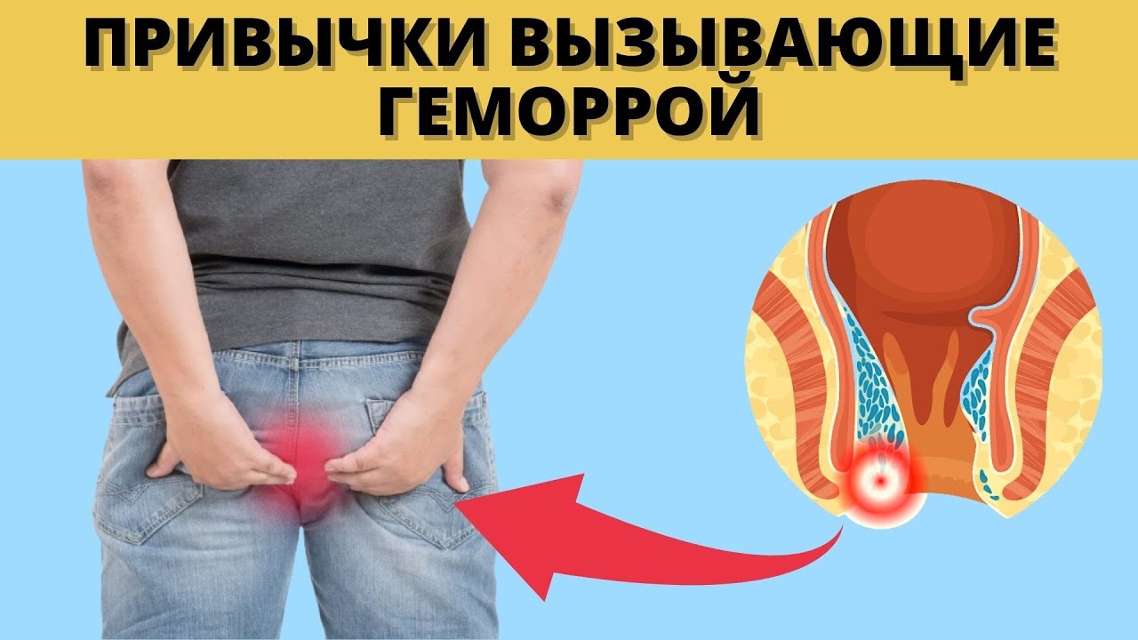 Занятие Анальным Сексом При Геморрое Занятие Анальным Сексом При Геморрое