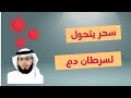 سحر يتحول لسرطان دم دكتور وسيم يوسف اكسبلور تفسير الأحلام