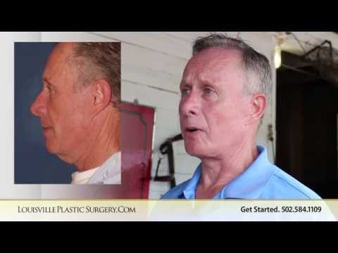 David — Neck lift · age 70
