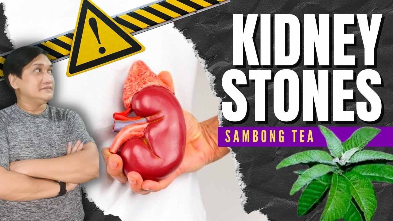 KIDNEY STONES HOME REMEDY SAMBONG TEA YouTube