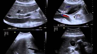 Webinar: Point-of-Care Ultrasound and the Hospitalist - Does it Matter? screenshot 4