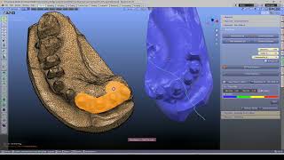 🦷 Use model sections to create one model | ICP Alignment