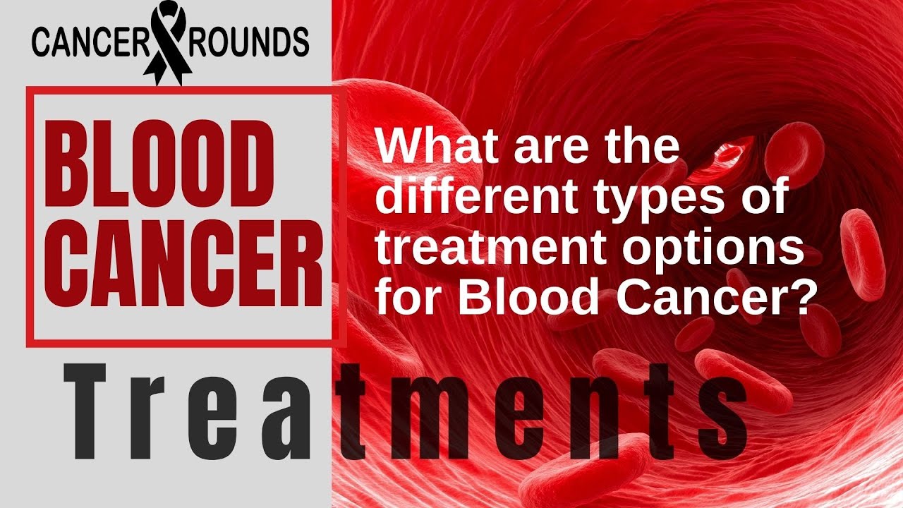 BLOOD CANCER TREATMENTS OPTIONS l Types on Treatments for Blood Cancer ...