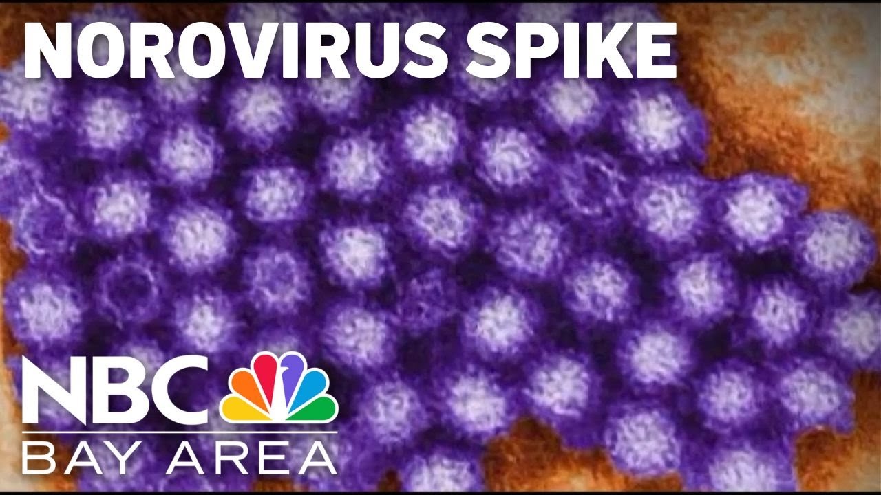What to know about a spike in norovirus cases