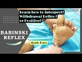 Babinski reflex-detailed assessment #Triplefelxionbabinski #withdrawlreflex #plantartest #neurology