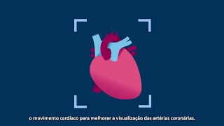 Philips CT 5300: projetado para a cardiologia
