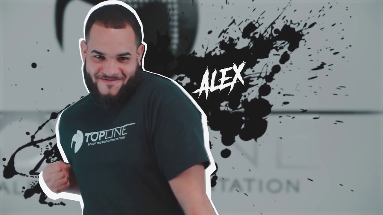 Topline Scalp Micropigmentation Intro