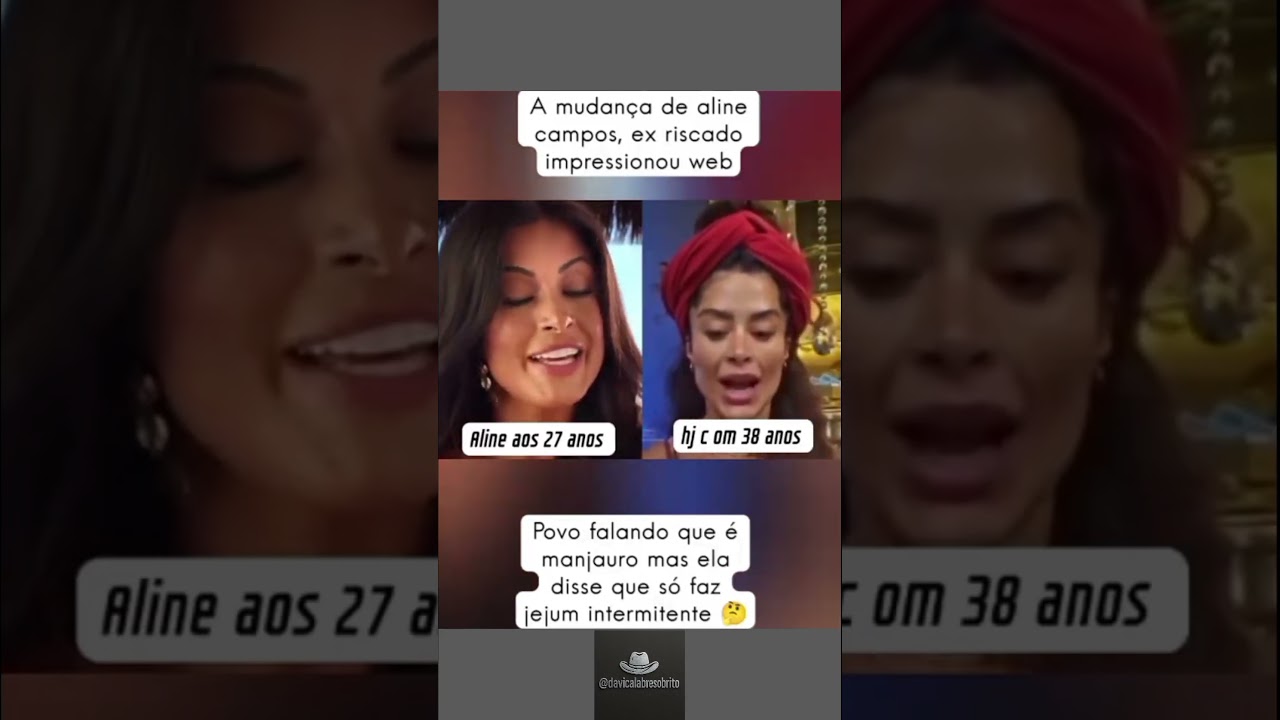 Antes e depois de Aline Riscado impressiona a web. 