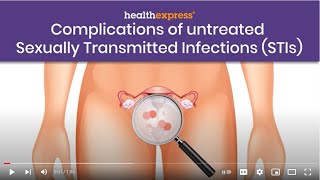 Complications Of Untreated Ually Transmitted Infections