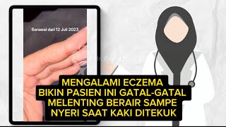 MENGALAMI ECZEMA BIKIN PASIEN INI GATALGATAL MELENTING BERAIR SAMPE NYERI SAAT KAKI DITEKUK