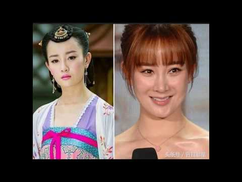 整容失敗的張檬取出假體 网友：又美回来了
